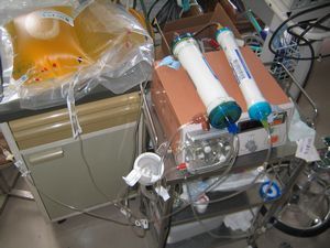 管が繋がっている黄色い液体の入った袋2つとその横にある透析の機械の写真