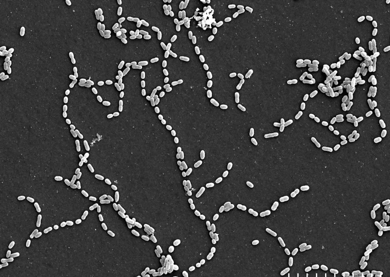 黒い背景にミュータンス菌がたくさんいる写真