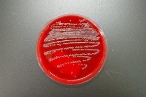 赤色の培地に白っぽい色の細菌がついている写真