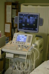 沢山のプローブなどのコードが付いて画面に波形が表示されている腹部超音波検査の機器の写真