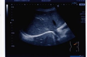 腹腔内の臓器が映し出された腹部超音波検査の画像の写真