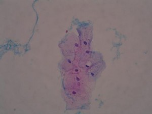 薄ピンク色に染色された細胞の写真