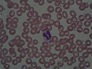 血液細胞を顕微鏡で見た血液像の画像の写真